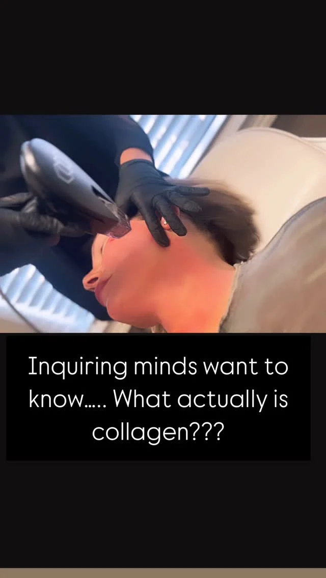 Can you medisplain that to me please?! I want to be collagenius……. #collageninductiontherapy #microneedling 
How it Works: 🙌
* Tiny, sterilized needles are punctured into the skin, creating micro-injuries.  
* These micro-injuries trigger the body’s healing process, leading to increased production of collagen and elastin.  
* The resulting increase in collagen helps improve skin texture, reduce wrinkles, and minimize scars. 

🤩Benefits 

Reduces fine lines and wrinkles, Improves skin texture and tone, Treats acne scars and other scars, Stimulates hair growth, and Tightens and lifts the skin. 

⌛️Lasting Results

It’s essential to recognize that this is not a one-and-done procedure. The most effective and enduring results typically occur after a series of treatments. As the body continues to generate new collagen, improvements can continue for up to six months following a single procedure. 
Experience the difference! Book with Us!
Serving Knoxville & Surrounding Areas of East TN

📍#aestheticelevationknox
📧 info@aestheticelevationknox.com
💻 aestheticelevation.com 
📆 https://dashboard.boulevard.io/booking/businesses/7b4f475a-8309-4e2e-bf3f-67d315011e8f/widget#/visit-type
☎️ (865) 313-3409 Call or Text

🙌Home of Optimas MAX featuring the most advanced technology in East Tennessee! 

🎉Celebrating 2 Years of ELEVATING your experience and reaching new heights with our clients at AEK! 

📈Female owned with over 20 years of medical and aesthetics experience!